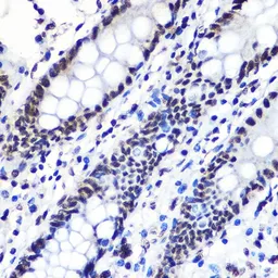 Anti-IKB alpha (phospho Ser36) antibody [GT1298] used in IHC (Paraffin sections) (IHC-P). GTX03210