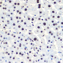 Anti-IKB alpha (phospho Ser36) antibody [GT1298] used in IHC (Paraffin sections) (IHC-P). GTX03210