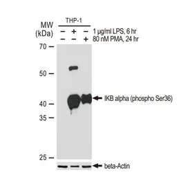 Anti-IKB alpha (phospho Ser36) antibody [GT1298] used in Western Blot (WB). GTX03210