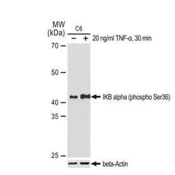 Anti-IKB alpha (phospho Ser36) antibody [GT1298] used in Western Blot (WB). GTX03210