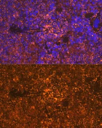 Anti-Oncostatin M antibody [GT1300] used in IHC (Paraffin sections) (IHC-P). GTX03212
