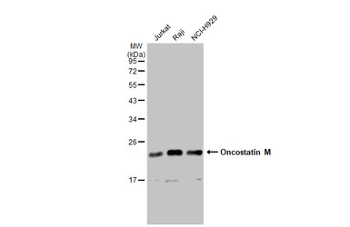 Anti-Oncostatin M antibody [GT1300] used in Western Blot (WB). GTX03212