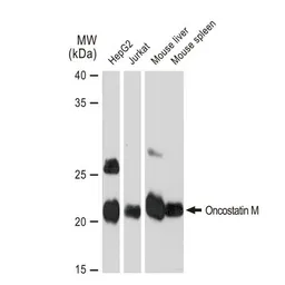 Anti-Oncostatin M antibody [GT1300] used in Western Blot (WB). GTX03212
