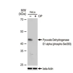 Anti-Pyruvate Dehydrogenase E1 alpha (phospho Ser293) antibody [GT1301] used in Western Blot (WB). GTX03213