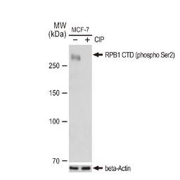 Anti-RPB1 CTD (phospho Ser2) antibody [GT1302] used in Western Blot (WB). GTX03214