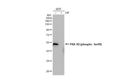 Anti-PKA R2 (phospho Ser99) antibody [GT1304] used in Western Blot (WB). GTX03216