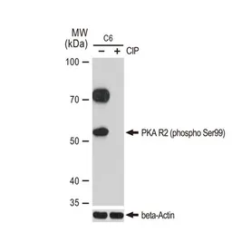 Anti-PKA R2 (phospho Ser99) antibody [GT1304] used in Western Blot (WB). GTX03216