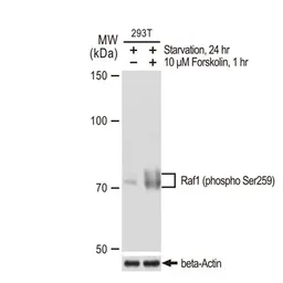 Anti-Raf1 (phospho Ser259) antibody [GT1309] used in Western Blot (WB). GTX03221