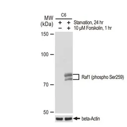 Anti-Raf1 (phospho Ser259) antibody [GT1309] used in Western Blot (WB). GTX03221
