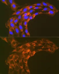 Anti-RPS20 antibody [GT1310] used in Immunocytochemistry/ Immunofluorescence (ICC/IF). GTX03222