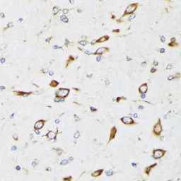 Anti-RPS20 antibody [GT1310] used in IHC (Paraffin sections) (IHC-P). GTX03222