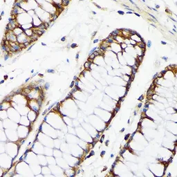 Anti-RPS20 antibody [GT1310] used in IHC (Paraffin sections) (IHC-P). GTX03222
