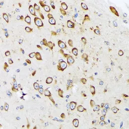 Anti-RPS20 antibody [GT1310] used in IHC (Paraffin sections) (IHC-P). GTX03222