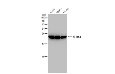 Anti-SFRS3 antibody [GT1312] used in Western Blot (WB). GTX03224