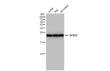 Anti-SFRS3 antibody [GT1312] used in Western Blot (WB). GTX03224