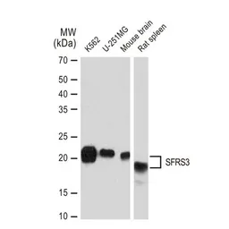 Anti-SFRS3 antibody [GT1312] used in Western Blot (WB). GTX03224