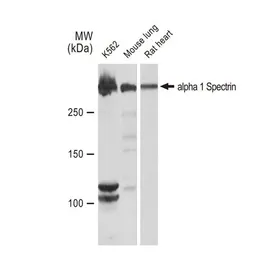 Anti-alpha 1 Spectrin antibody [GT1313] used in Western Blot (WB). GTX03225