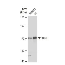 Anti-TFE3 antibody [GT1317] used in Western Blot (WB). GTX03229