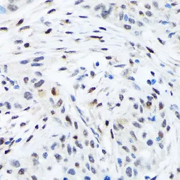 Anti-TFE3 antibody [GT1317] used in IHC (Paraffin sections) (IHC-P). GTX03229