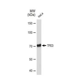 Anti-TFE3 antibody [GT1317] used in Western Blot (WB). GTX03229