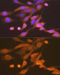 Anti-Xanthine Oxidase antibody [GT1319] used in Immunocytochemistry/ Immunofluorescence (ICC/IF). GTX03231