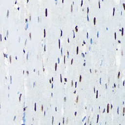 Anti-UAP56 antibody [GT1320] used in IHC (Paraffin sections) (IHC-P). GTX03232