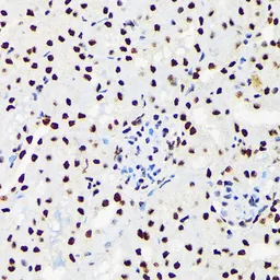 Anti-UAP56 antibody [GT1320] used in IHC (Paraffin sections) (IHC-P). GTX03232