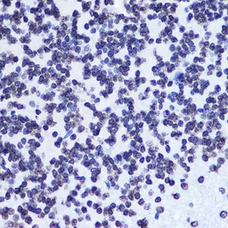 Anti-SMC1 (phospho Ser957) antibody [GT1321] used in IHC (Paraffin sections) (IHC-P). GTX03233