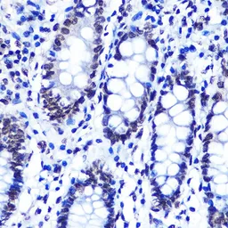 Anti-SMC1 (phospho Ser957) antibody [GT1321] used in IHC (Paraffin sections) (IHC-P). GTX03233