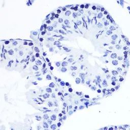 Anti-SMC1 (phospho Ser957) antibody [GT1321] used in IHC (Paraffin sections) (IHC-P). GTX03233