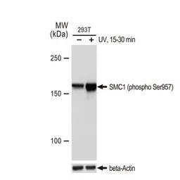 Anti-SMC1 (phospho Ser957) antibody [GT1321] used in Western Blot (WB). GTX03233