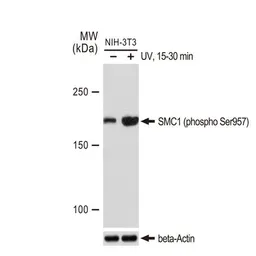 Anti-SMC1 (phospho Ser957) antibody [GT1321] used in Western Blot (WB). GTX03233