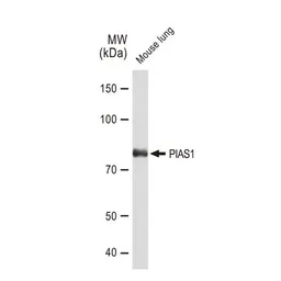 Anti-PIAS1 antibody [GT1323] used in Western Blot (WB). GTX03235