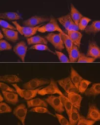 Anti-SOCS2 antibody [GT1326] used in Immunocytochemistry/ Immunofluorescence (ICC/IF). GTX03238
