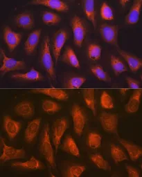Anti-SOCS2 antibody [GT1326] used in Immunocytochemistry/ Immunofluorescence (ICC/IF). GTX03238
