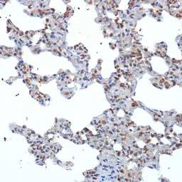 Anti-SOCS2 antibody [GT1326] used in IHC (Paraffin sections) (IHC-P). GTX03238