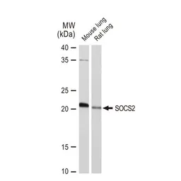 Anti-SOCS2 antibody [GT1326] used in Western Blot (WB). GTX03238