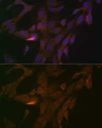 Anti-PER3 antibody [GT1327] used in Immunocytochemistry/ Immunofluorescence (ICC/IF). GTX03239