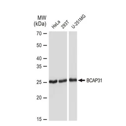 Anti-BCAP31 antibody [GT1333] used in Western Blot (WB). GTX03245