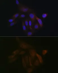 Anti-BCAP31 antibody [GT1333] used in Immunocytochemistry/ Immunofluorescence (ICC/IF). GTX03245