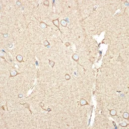 Anti-BCAP31 antibody [GT1333] used in IHC (Paraffin sections) (IHC-P). GTX03245