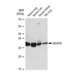 Anti-BCAP31 antibody [GT1333] used in Western Blot (WB). GTX03245