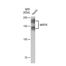 Anti-MERTK antibody [GT1335] used in Western Blot (WB). GTX03247
