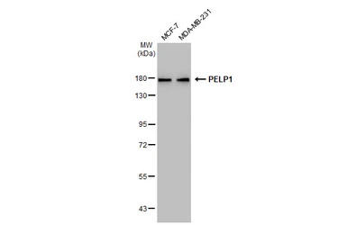 Anti-PELP1 antibody [GT1339] used in Western Blot (WB). GTX03251