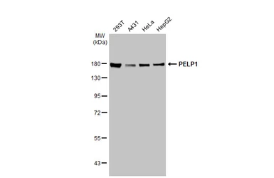 Anti-PELP1 antibody [GT1339] used in Western Blot (WB). GTX03251