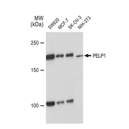 Anti-PELP1 antibody [GT1339] used in Western Blot (WB). GTX03251