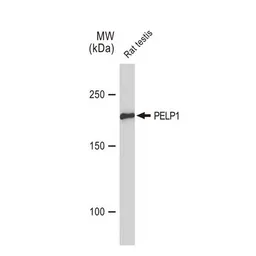 Anti-PELP1 antibody [GT1339] used in Western Blot (WB). GTX03251