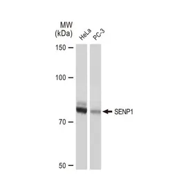 Anti-SENP1 antibody [GT1340] used in Western Blot (WB). GTX03252