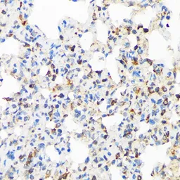 Anti-TIRAP antibody [GT1343] used in IHC (Paraffin sections) (IHC-P). GTX03255