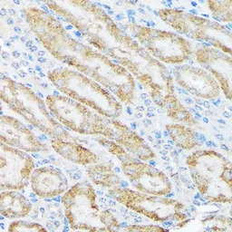 Anti-TIRAP antibody [GT1343] used in IHC (Paraffin sections) (IHC-P). GTX03255